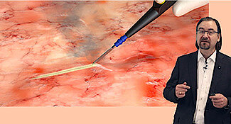 A man is explaining the smoke evacuation with the IES3 in a videocourse.